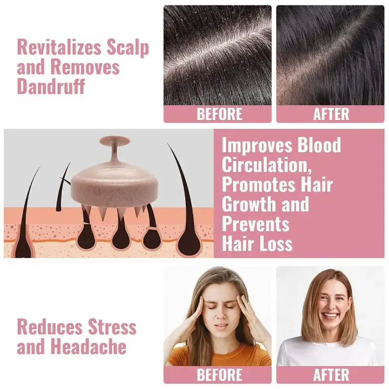 Round Scalp Massager & Shampoo Brush with Soft Bristles Round Scalp Massager